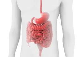 Inflammatory bowel disease illustration
