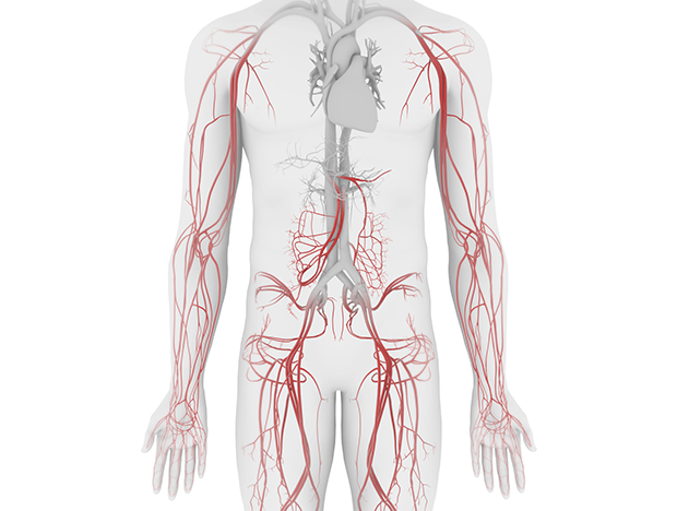 Hemophilia A