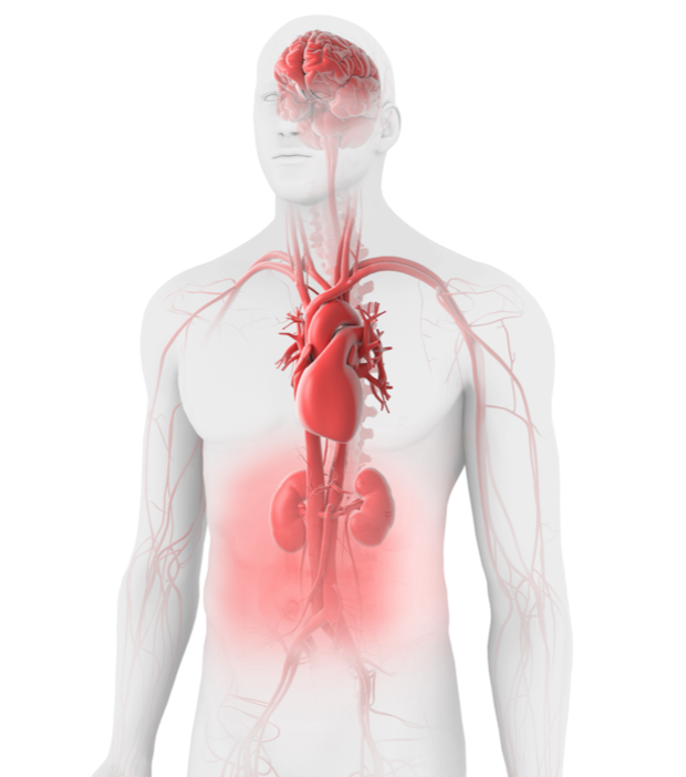 Congenital thrombotic thrombocytopenic purpura illustration