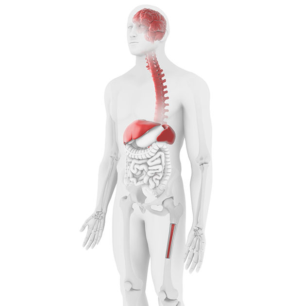 Gaucher disease illustration